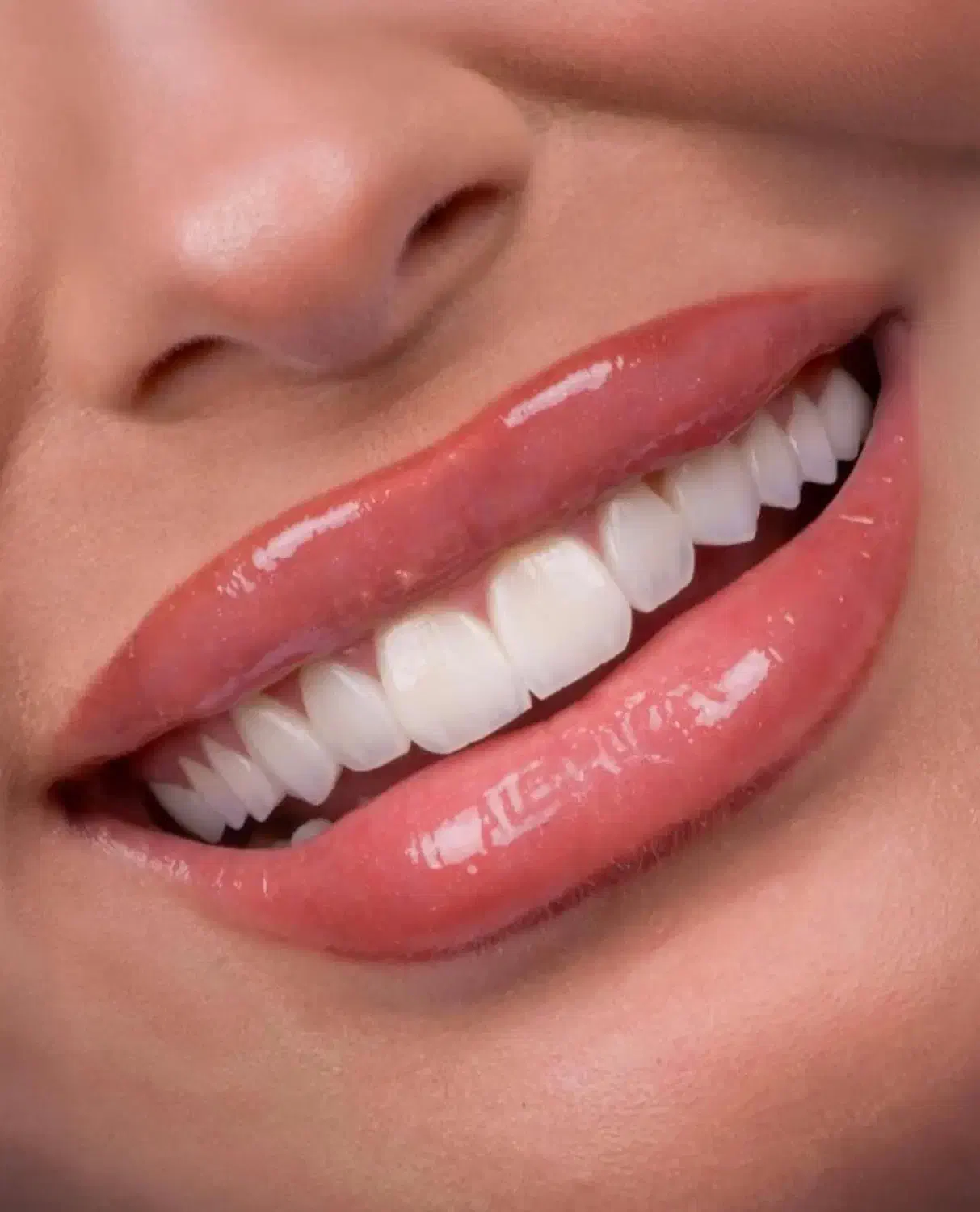 کامپوزیت دندان/تخفیف ویژه|خدمات آرایشگری و زیبایی|تهران, ایوانک|دیوار