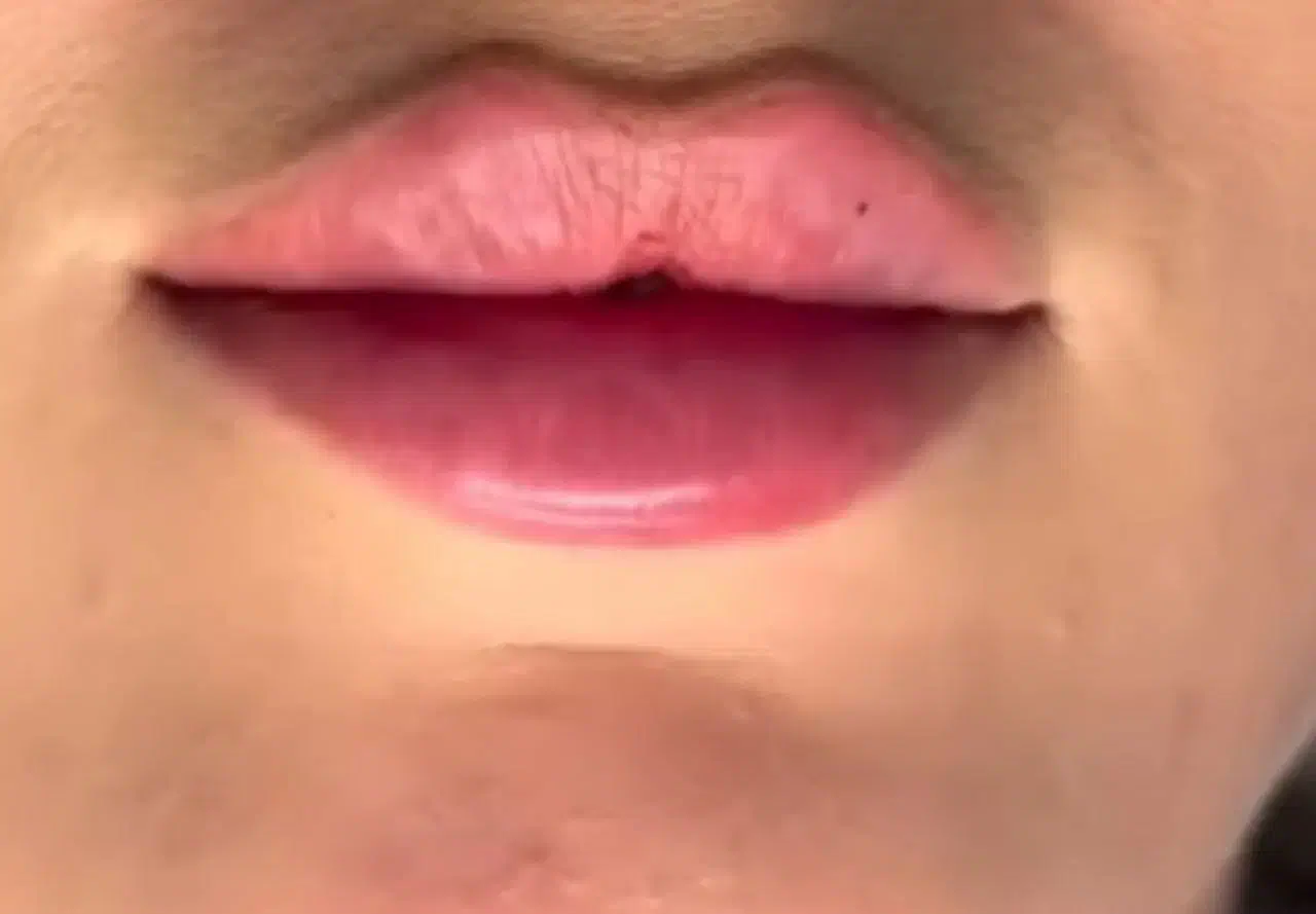 جشنواره پاییزه فیلر و بوتاکس با ۵۰ درصد تخفیف|خدمات آرایشگری و زیبایی|تهران, قیطریه|دیوار