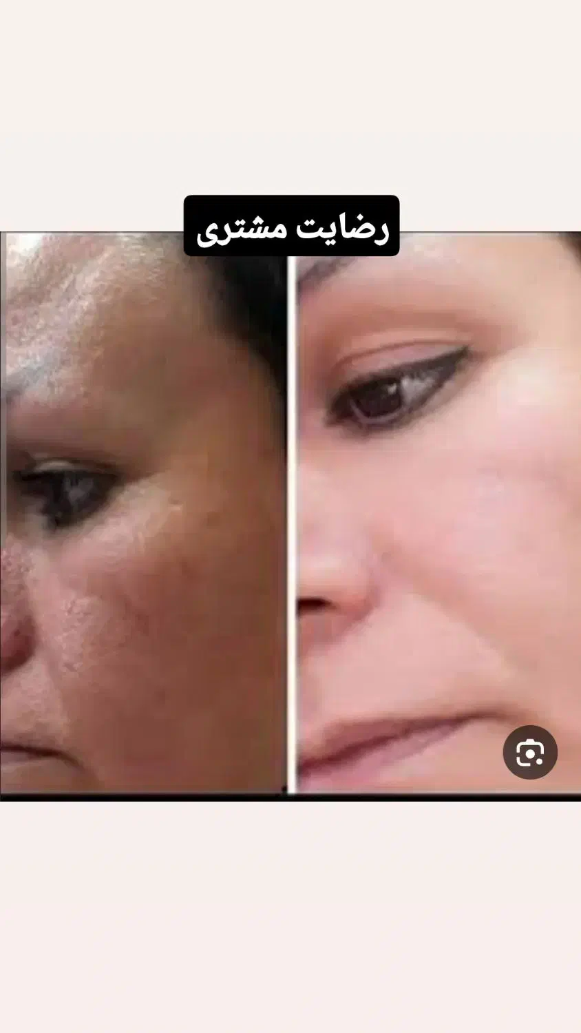 کرم آیدن معجزه خاورمیانه|آرایشی، بهداشتی، درمانی|ایرانشهر, |دیوار