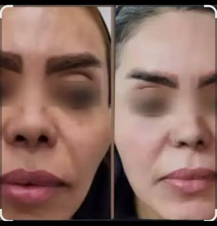 کرم Vip معجزه|آرایشی، بهداشتی، درمانی|یاسوج, |دیوار