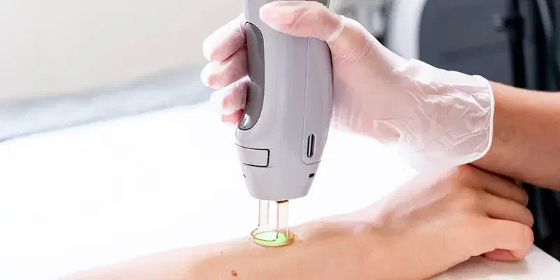 آموزش فیشیال،لیزر،کرم سازی،مزاج شناسی+مدرک معتبر|خدمات آموزشی|مشهد, راهنمایی|دیوار