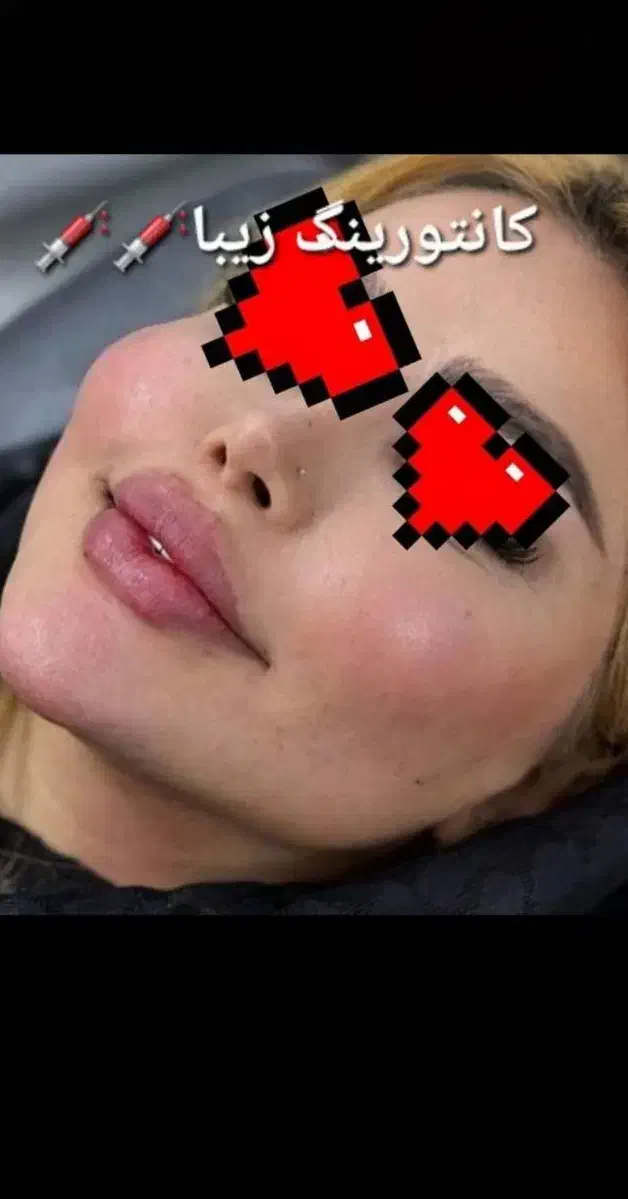 آموزش ژل وبوتاکس|خدمات آرایشگری و زیبایی|اهواز, فاز ۲ پادادشهر|دیوار