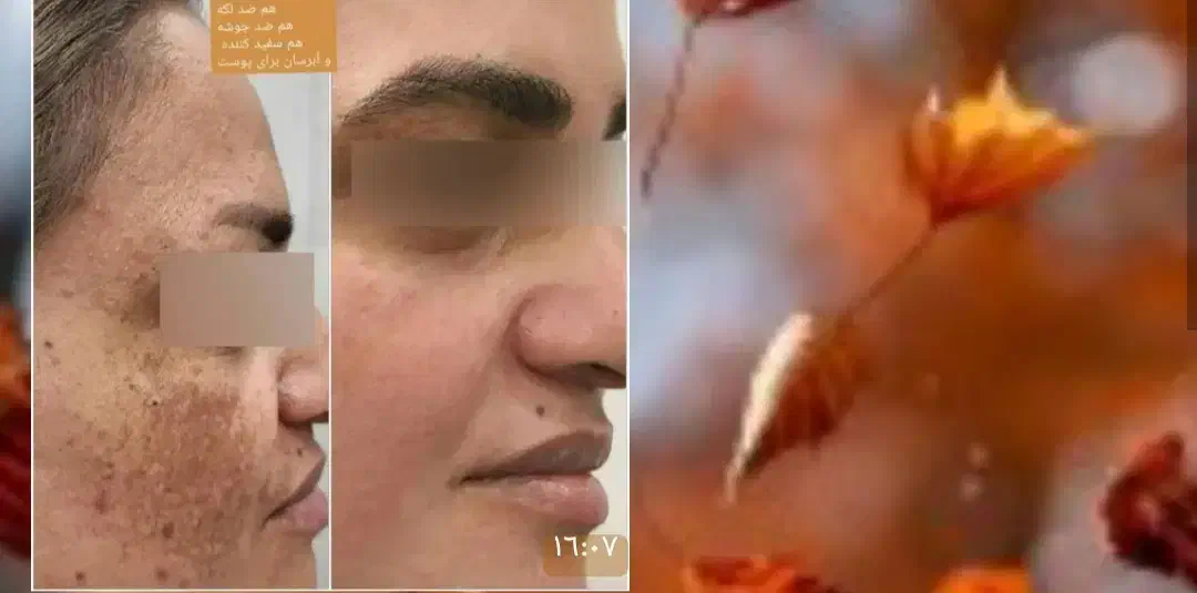 کرمهای ضدآفتاب بی رنگ و رنگی کرم ضدلک رضایت مشتری|آرایشی، بهداشتی، درمانی|لاهیجان, قیام|دیوار