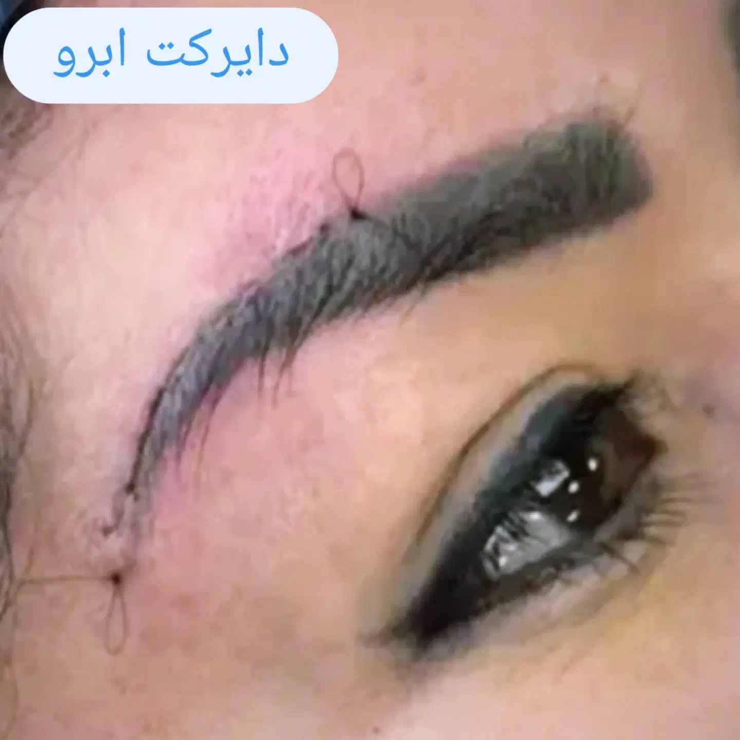 جراحی درمطب توسط پزشک جراح درخرم اباد|خدمات آرایشگری و زیبایی|دورود, |دیوار