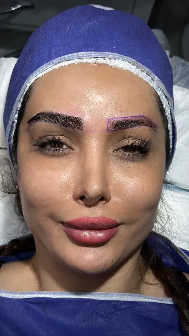 مشاوره کاشت مو،ابرو و کلیه خدمات زیبایی رایگان|خدمات آرایشگری و زیبایی|مشهد, فرهنگ|دیوار