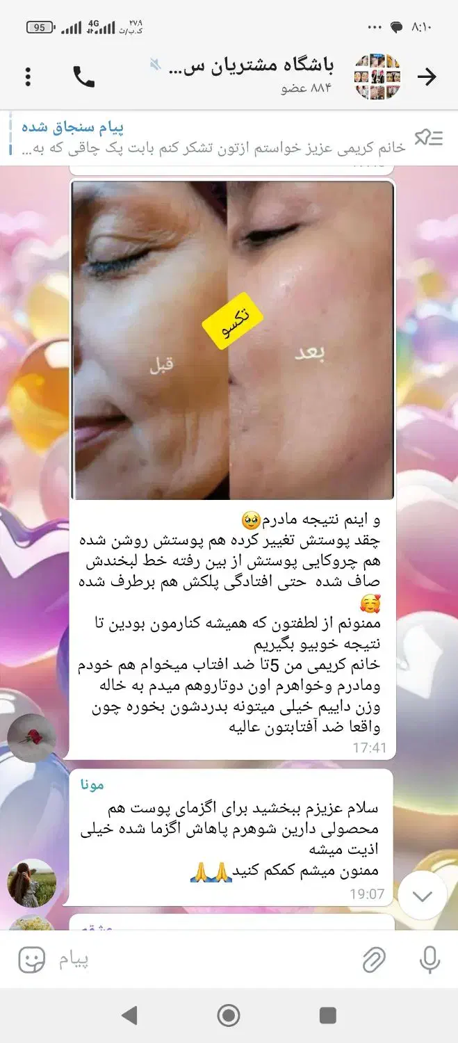 پوست هلویی زیبا بدون تزریق|آرایشی، بهداشتی، درمانی|اراک, |دیوار