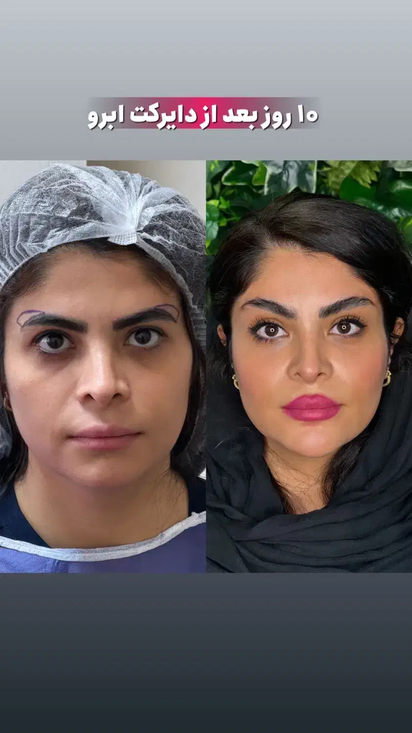 زیبایی ابرو و بلفارو|خدمات آرایشگری و زیبایی|تهران, سازمان برنامه جنوبی|دیوار