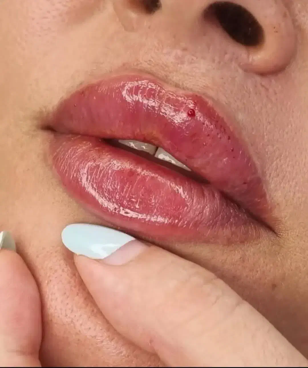 تزریق ژل وبوتاکس|خدمات آرایشگری و زیبایی|ساوه, |دیوار