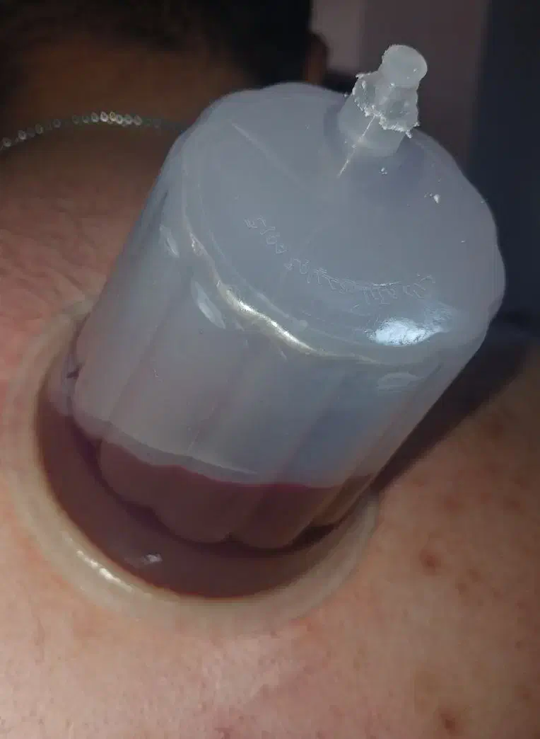 حجامت و فصد و فیزیوتراپی|خدمات آرایشگری و زیبایی|ورامین, ورامین|دیوار