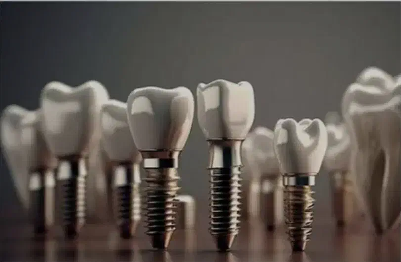 جشنواره ایمپلنت دیجیتال در شیراز|خدمات آرایشگری و زیبایی|جهرم, |دیوار