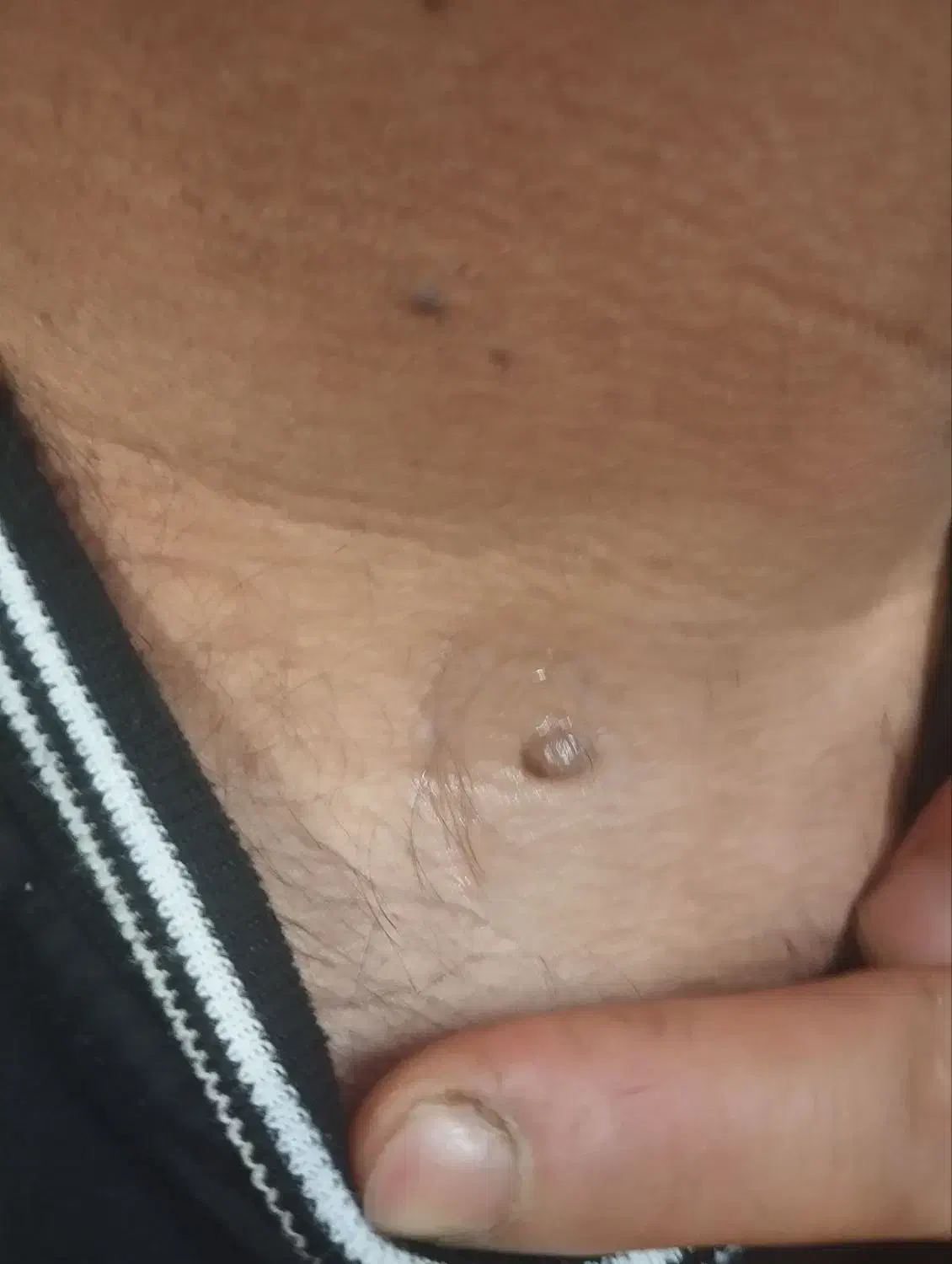 اصلاح خالبرداری لیزری پرسینگ گوش پاکسازی کامل پوست|خدمات آرایشگری و زیبایی|محمودآباد, |دیوار