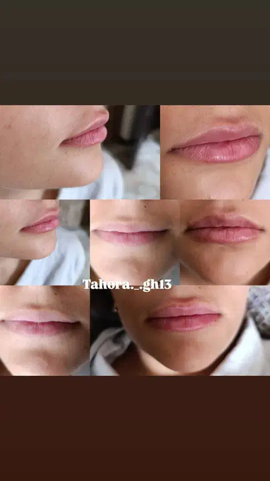 مدل ژل بوتاکس و پیرسینگ|خدمات آرایشگری و زیبایی|فولادشهر, مسکن مهر فولادشهر|دیوار