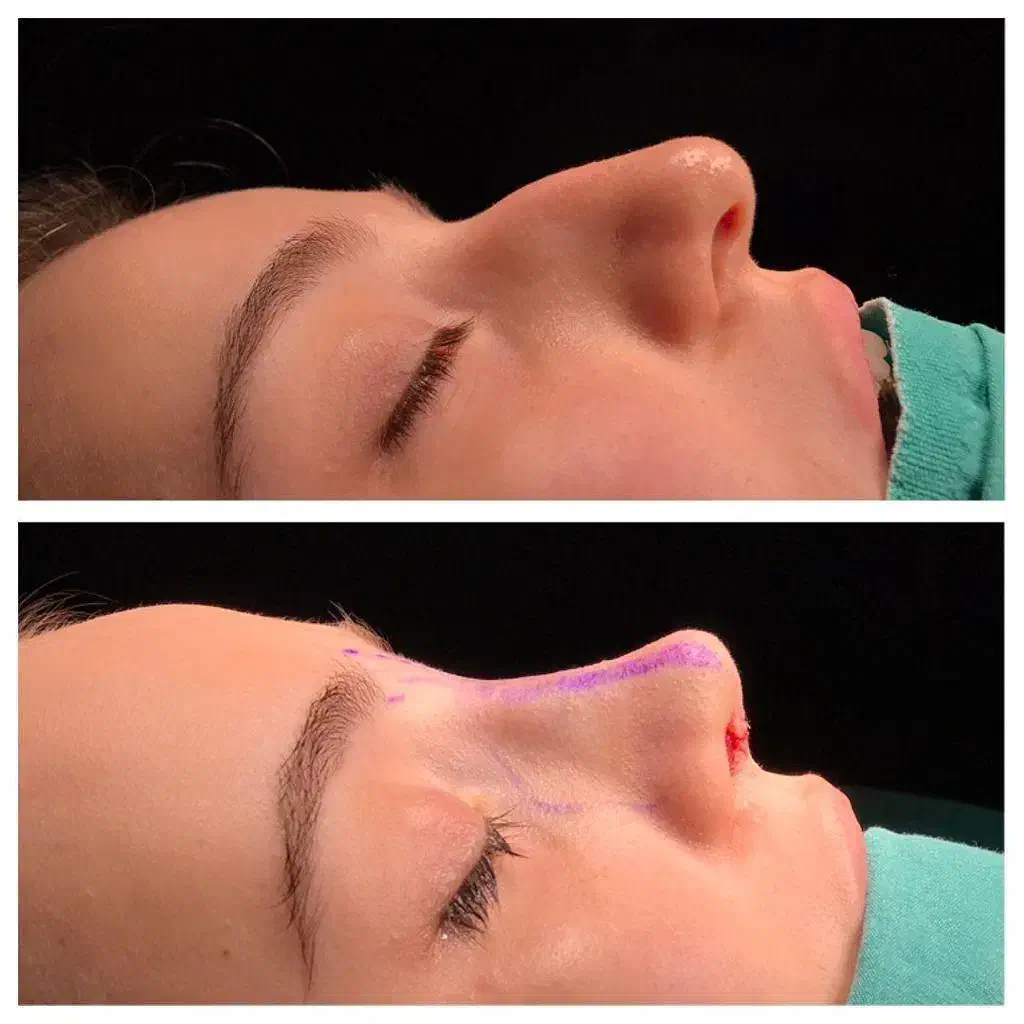 با ماهی ۲ میلیون بینی عمل کن|خدمات آرایشگری و زیبایی|اصفهان, ملک‌شهر|دیوار