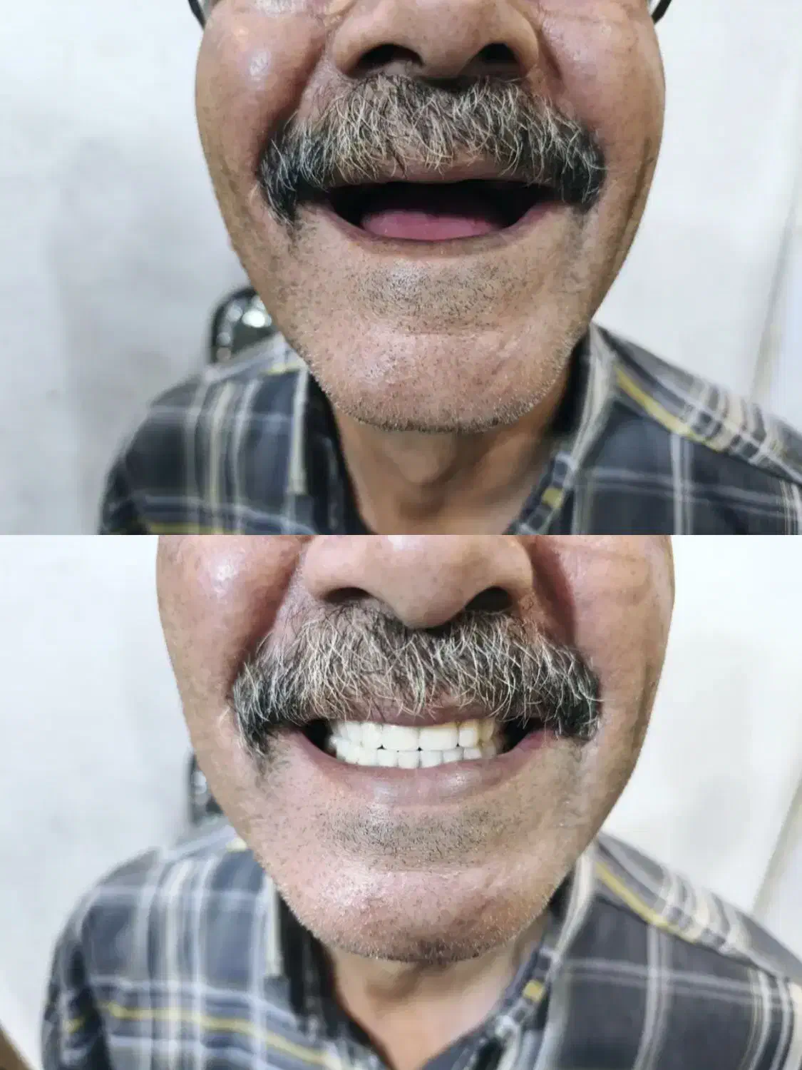 لابراتوار دندانسازی تخصصی(ساخت دندان مصنوعی)|حراج|اصفهان, کشاورزی|دیوار