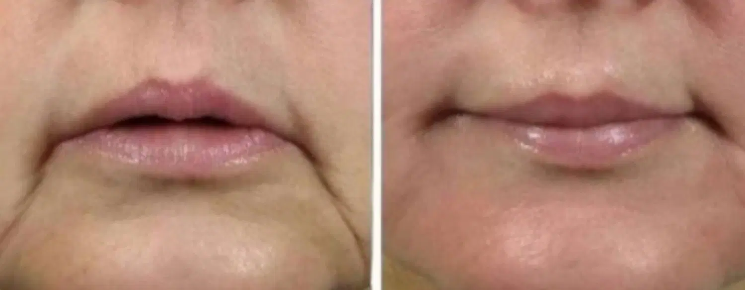 کلینیک زیبایی و تخصصی پوست و مو تخفیفهای ویژه|خدمات زیبایی و سلامت|تهران, مجیدآباد|دیوار