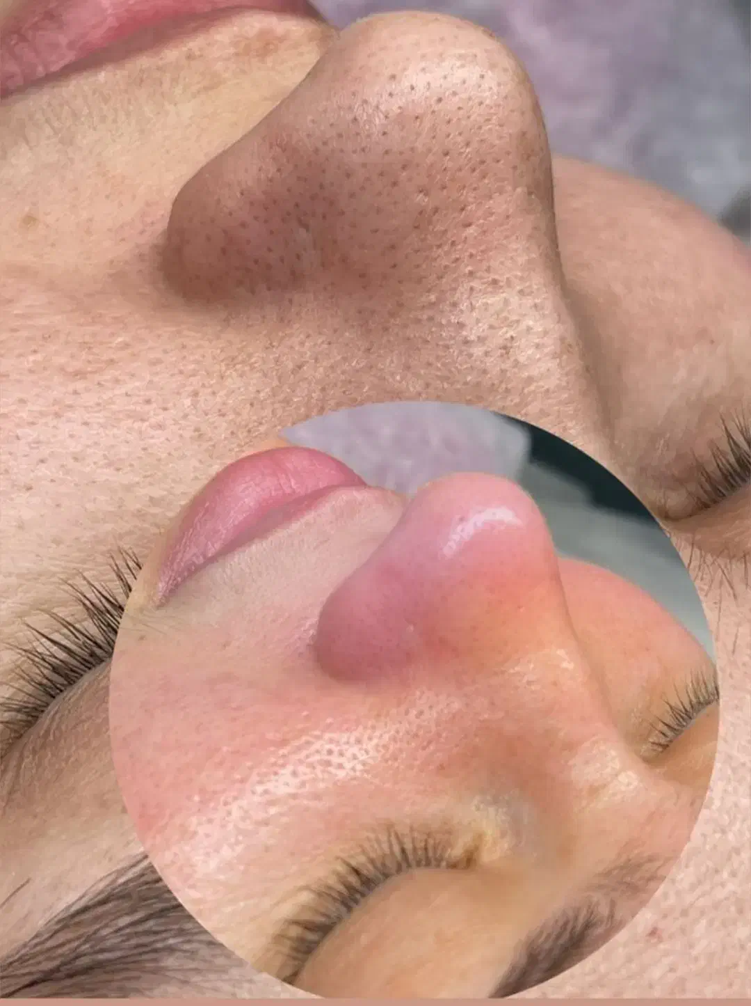 مدل فیشال و پاکسازی بانوان|خدمات آرایشگری و زیبایی|جیرفت, |دیوار