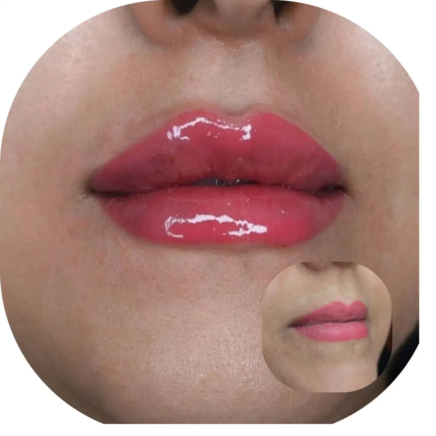 خدمات تتو و ژل و بوتاکس|خدمات آرایشگری و زیبایی|آبادان, |دیوار