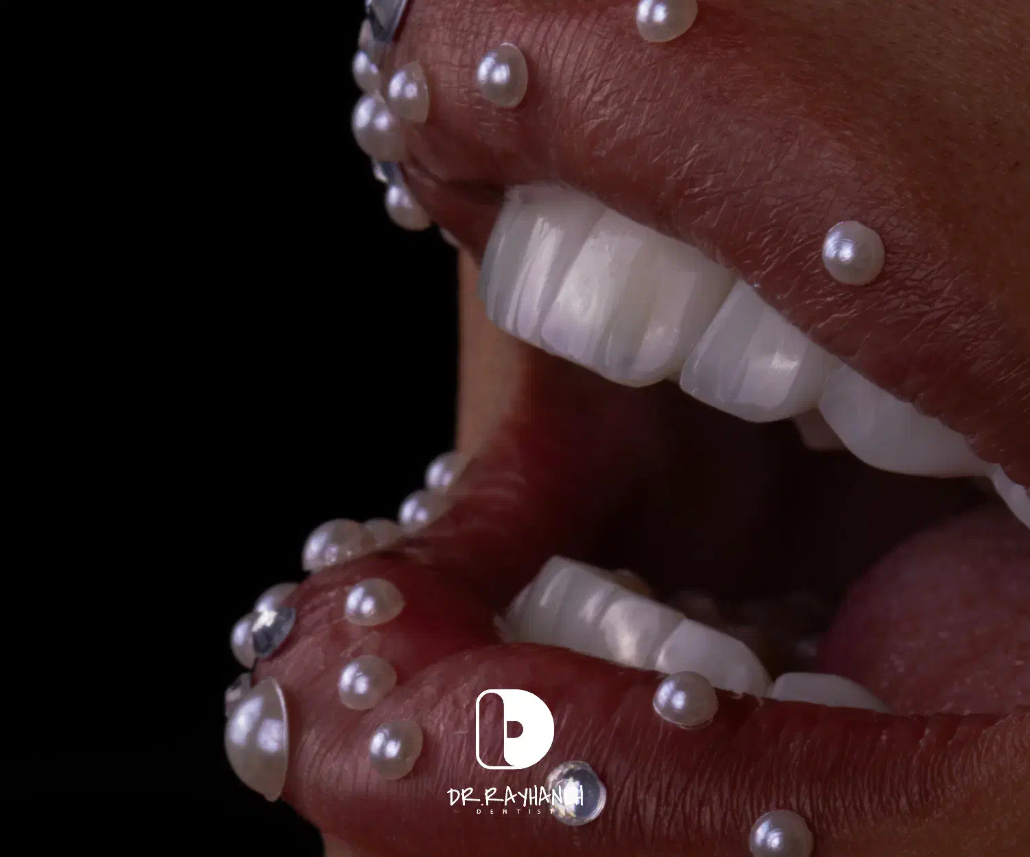 کامپوزیت/لمینت/دندانپزشکی|خدمات آرایشگری و زیبایی|مشهد, کوثر|دیوار