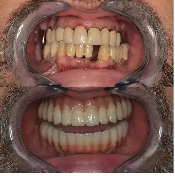 اقساط دندانپزشکی بدون پرداخت پول کلیه خدمات|خدمات آرایشگری و زیبایی|اصفهان, عطار نیشابوری|دیوار