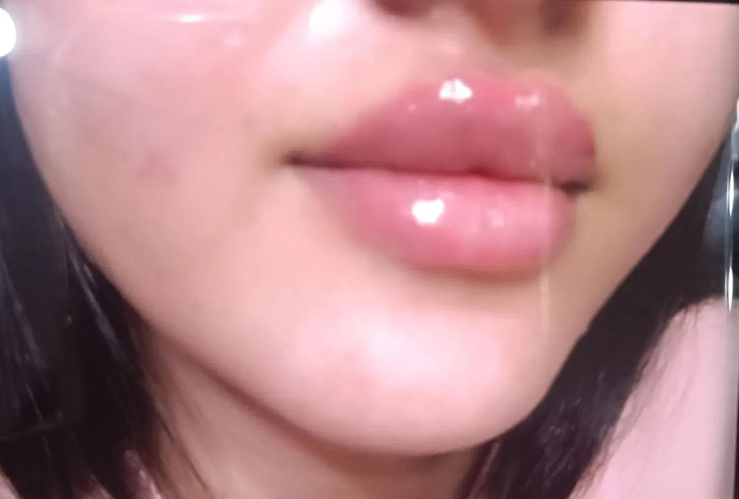 فیلر/ژل/بوتاکس ،بدون درد و کبودی|خدمات آرایشگری و زیبایی|شیراز, مسلم|دیوار
