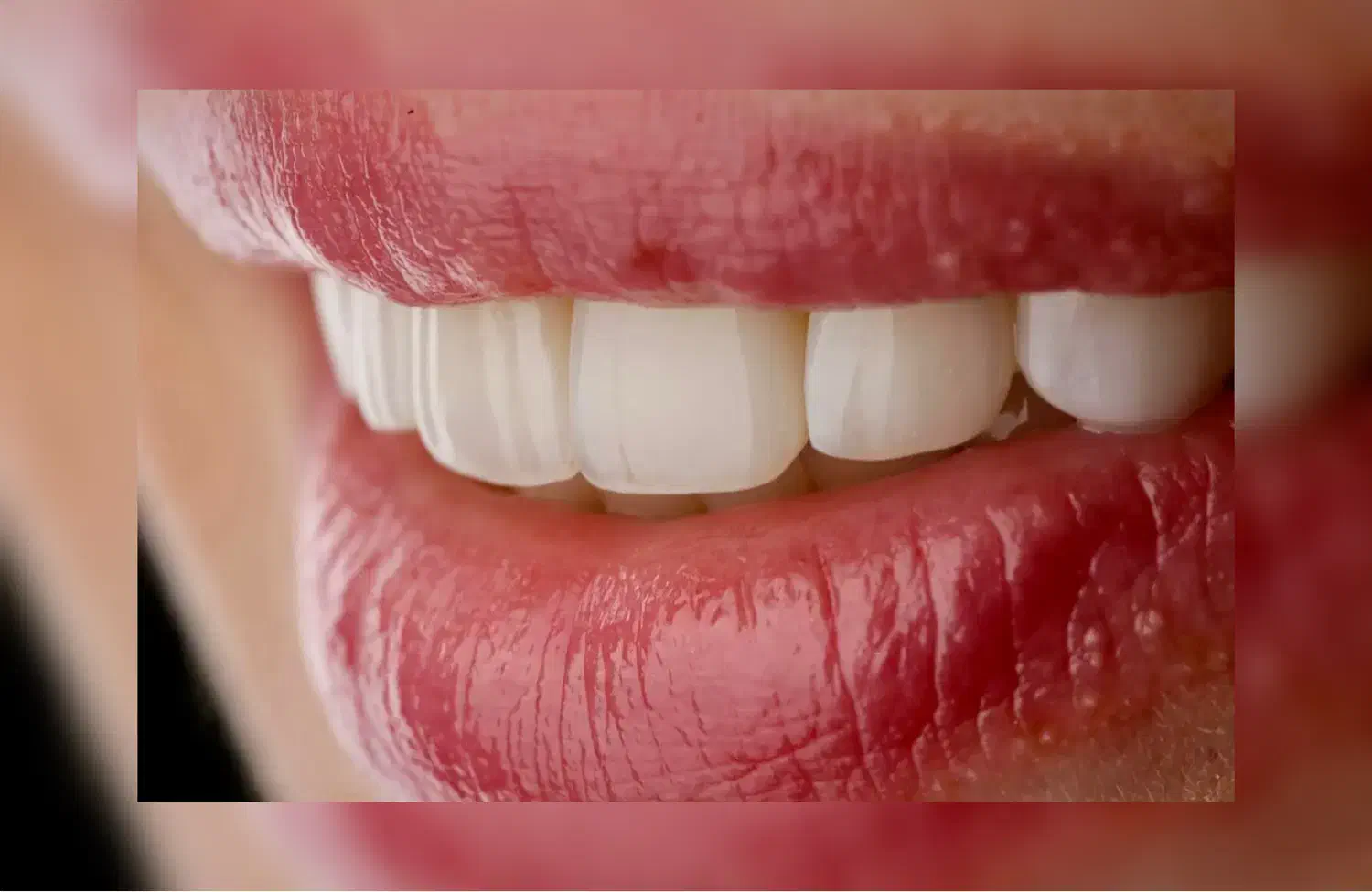 استخدام دستیار دندانپزشکی|استخدام درمانی، زیبایی، بهداشتی|اهواز, کیانپارس |دیوار