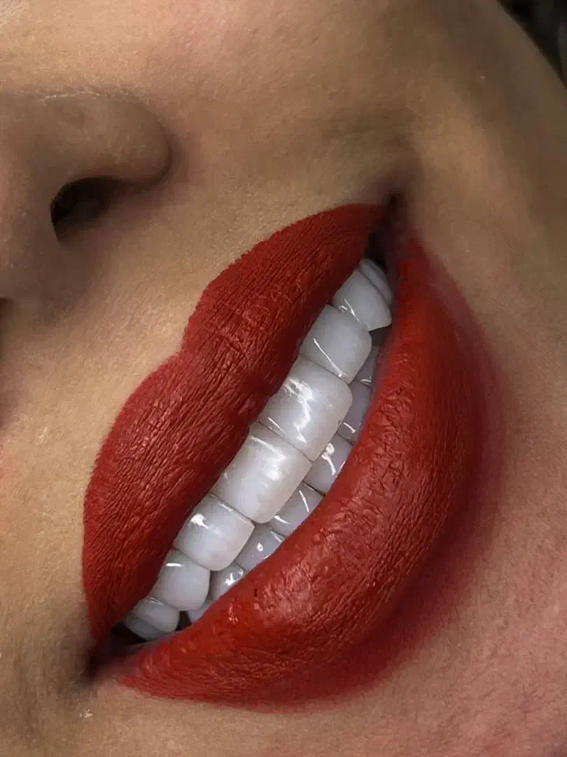 خدمات زیبایی دندان|خدمات آرایشگری و زیبایی|تهران, ولنجک|دیوار