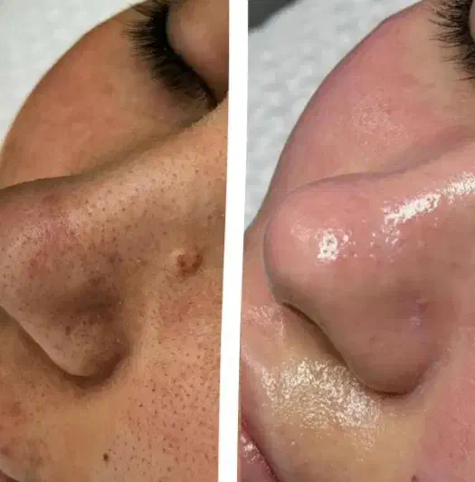 فیشال و پاکسازی پوست|خدمات آرایشگری و زیبایی|محمدشهر, محمدشهر|دیوار