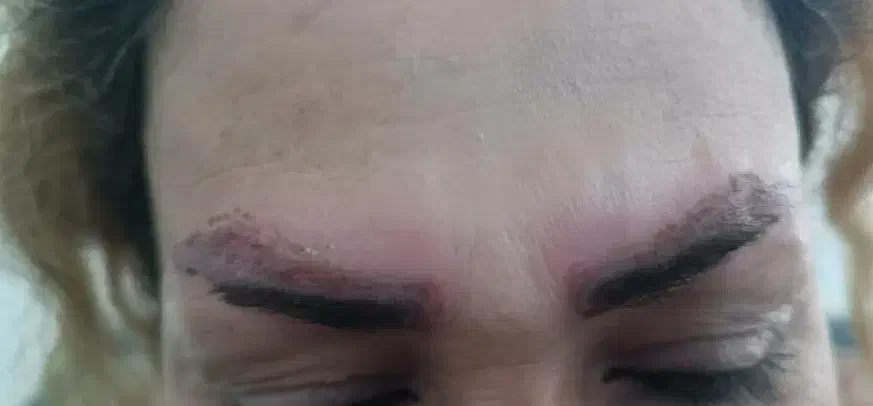 پاک کردن تتو ابرو ریمو تک جلسه ای تضمینی +آموزش|خدمات آرایشگری و زیبایی|خرم‌آباد, |دیوار