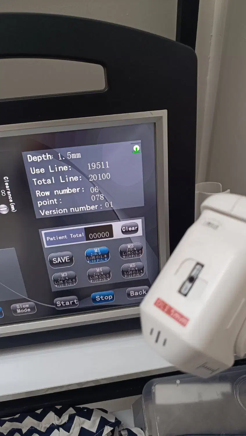 فروش دستگاه هایفوتراپی|آرایشگاه و سالن‌های زیبایی|کاشمر, |دیوار