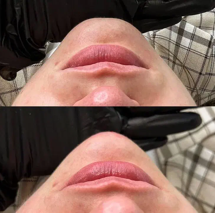 تزریق ژل و بوتاکس|خدمات آرایشگری و زیبایی|کرج, گلشهر|دیوار