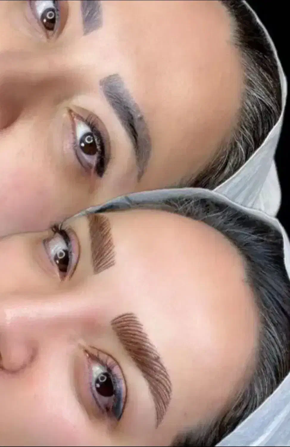 پاک کردن انواع تتو و خالکوبی بالیزر تخصصی کیوسویچ|خدمات آرایشگری و زیبایی|فولادشهر, پارک کوهستان|دیوار