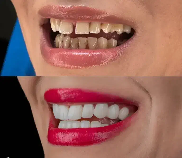 انجام کلیه امور تخصصی و فوق تخصصی دندان|خدمات آرایشگری و زیبایی|زرند, |دیوار
