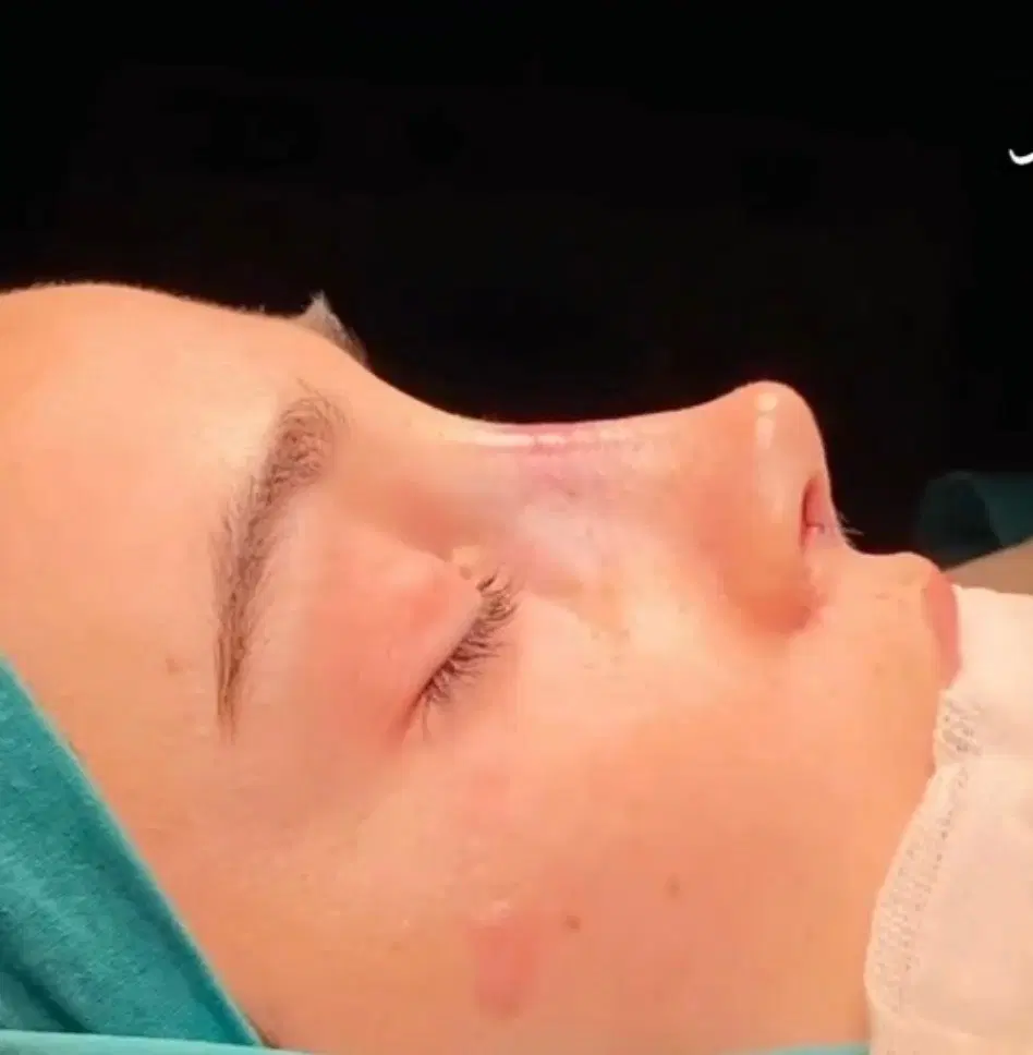 عمل جراحی زیبایی بینی،پلک،لیفت صورت،اندام|خدمات زیبایی و سلامت|تهران, نیروی هوایی (پیروزی)|دیوار