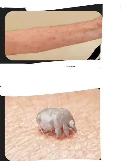 درمان گال|آرایشی، بهداشتی، درمانی|اسلام‌‌آباد غرب, |دیوار