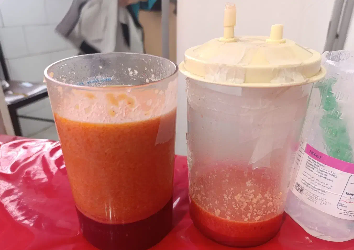 لیپو ساکشن تا عید خوشتیپ شوید|خدمات آرایشگری و زیبایی|خرم‌آباد, |دیوار