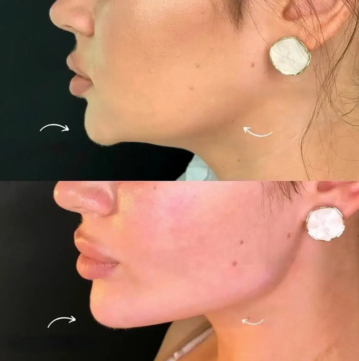 جشنواره ژل و بوتاکس با قیمت باورنکردنی/اقساط|خدمات آرایشگری و زیبایی|آمل, |دیوار