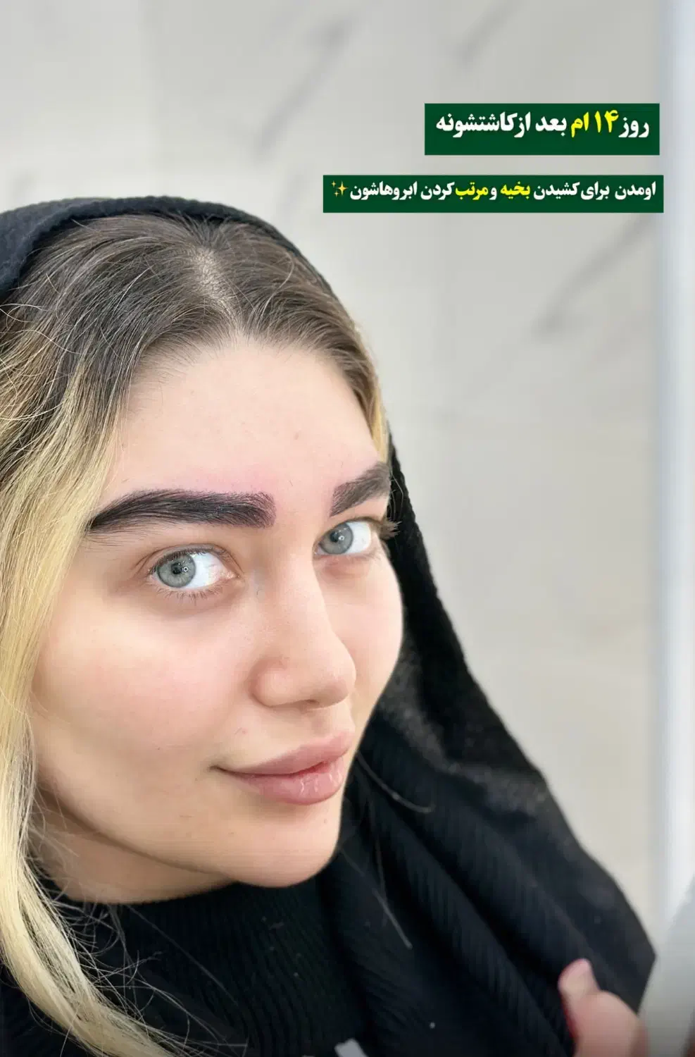 کاشت میکرو ابرو بدون برش بدون بخیه بدون مسواکی شدن|خدمات آرایشگری و زیبایی|تبریز, |دیوار
