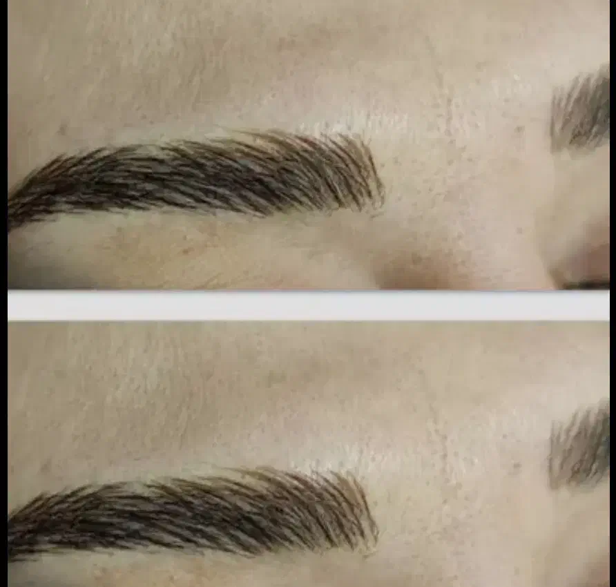 مدل زیبایی داعم صورت رایگان|خدمات آرایشگری و زیبایی|کرج, شهرک علی ابن ابیطالب (کوثر)|دیوار