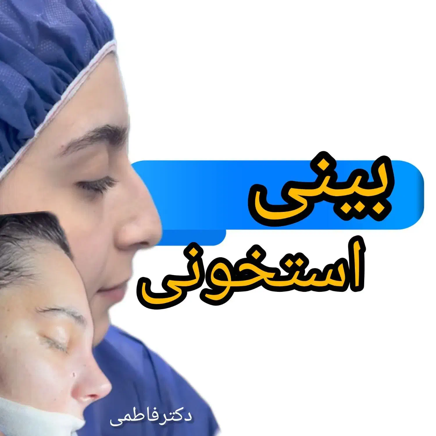 جراحی بینی دربیمارستان|خدمات آرایشگری و زیبایی|تهران, میدان ولیعصر|دیوار
