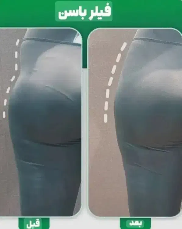 آموزش و خدمات فیلر بادی باسن بیکینی دست و پا|خدمات آرایشگری و زیبایی|قم, زنبیل آباد|دیوار