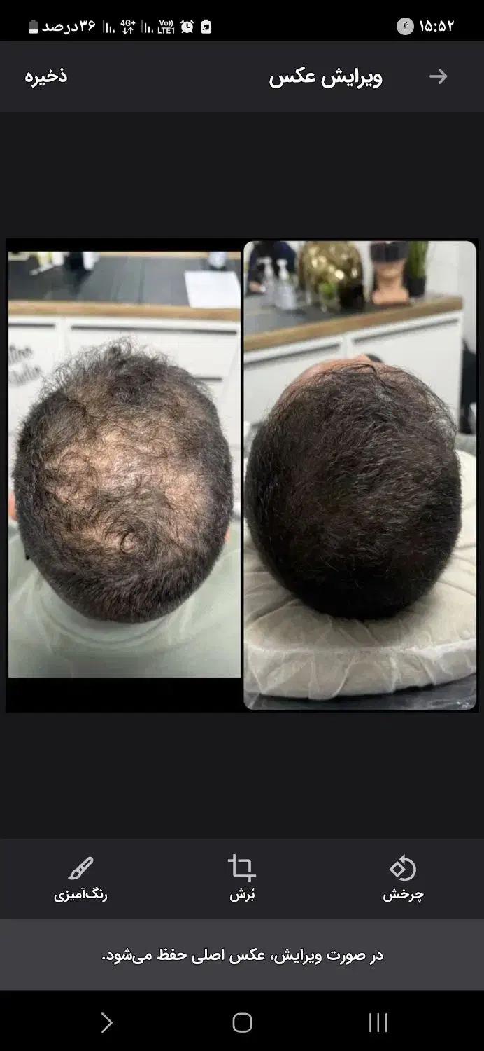 ریزش مو/رویش مجدد/رشد قدی مو /درمان کم پشتی مو|آرایشی، بهداشتی، درمانی|چاه داد خدا, |دیوار