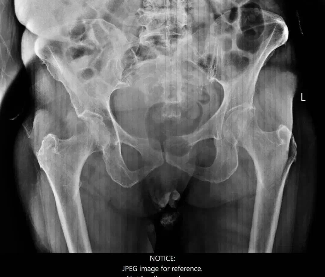 رادیولوژی و سونوگرافی در منزل تهران و کرج|پزشکی|تهران, ونک|دیوار