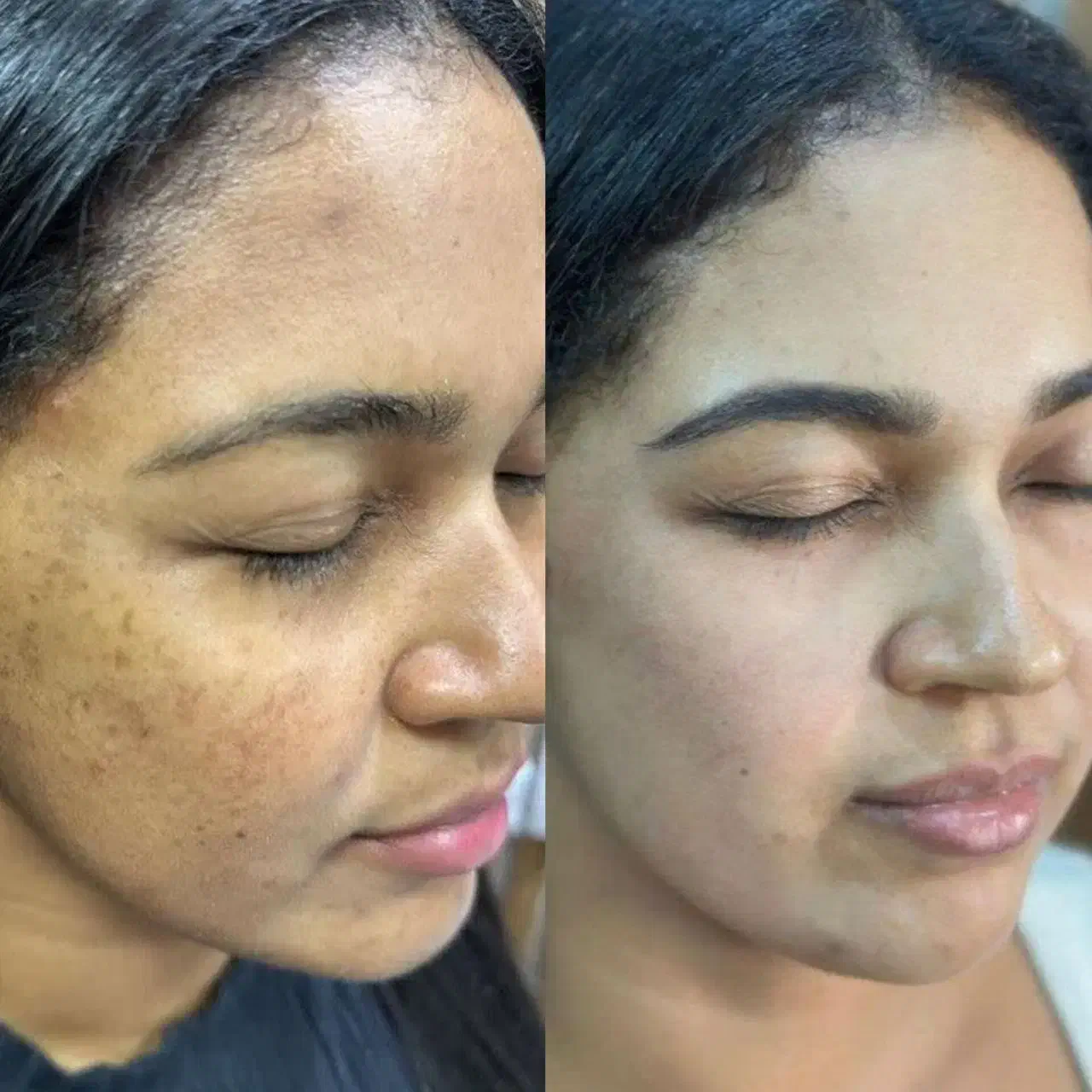 پوست و موی زیبا|آرایشی، بهداشتی، درمانی|ساری, |دیوار