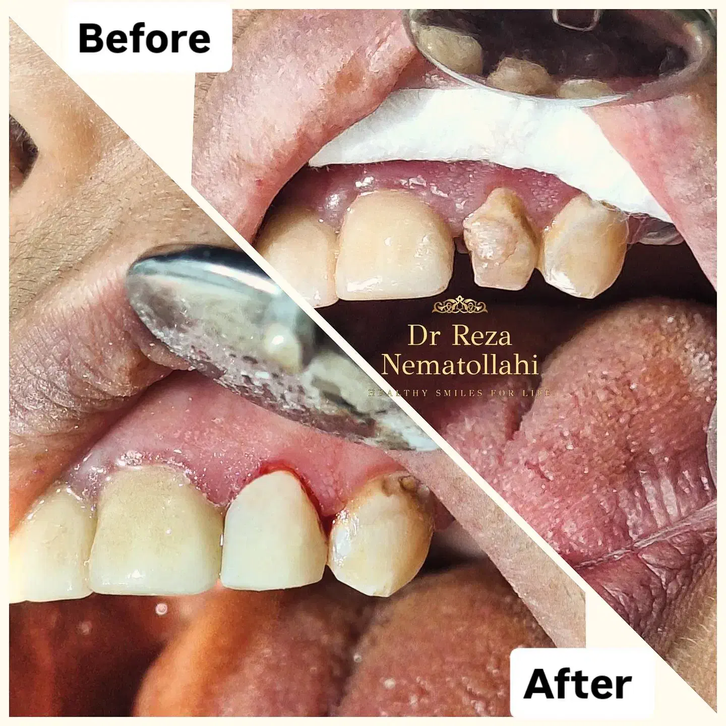 خدمات دندانپزشکی با بهترین کیفیت و پرداخت آسان|خدمات آرایشگری و زیبایی|اقلید, |دیوار