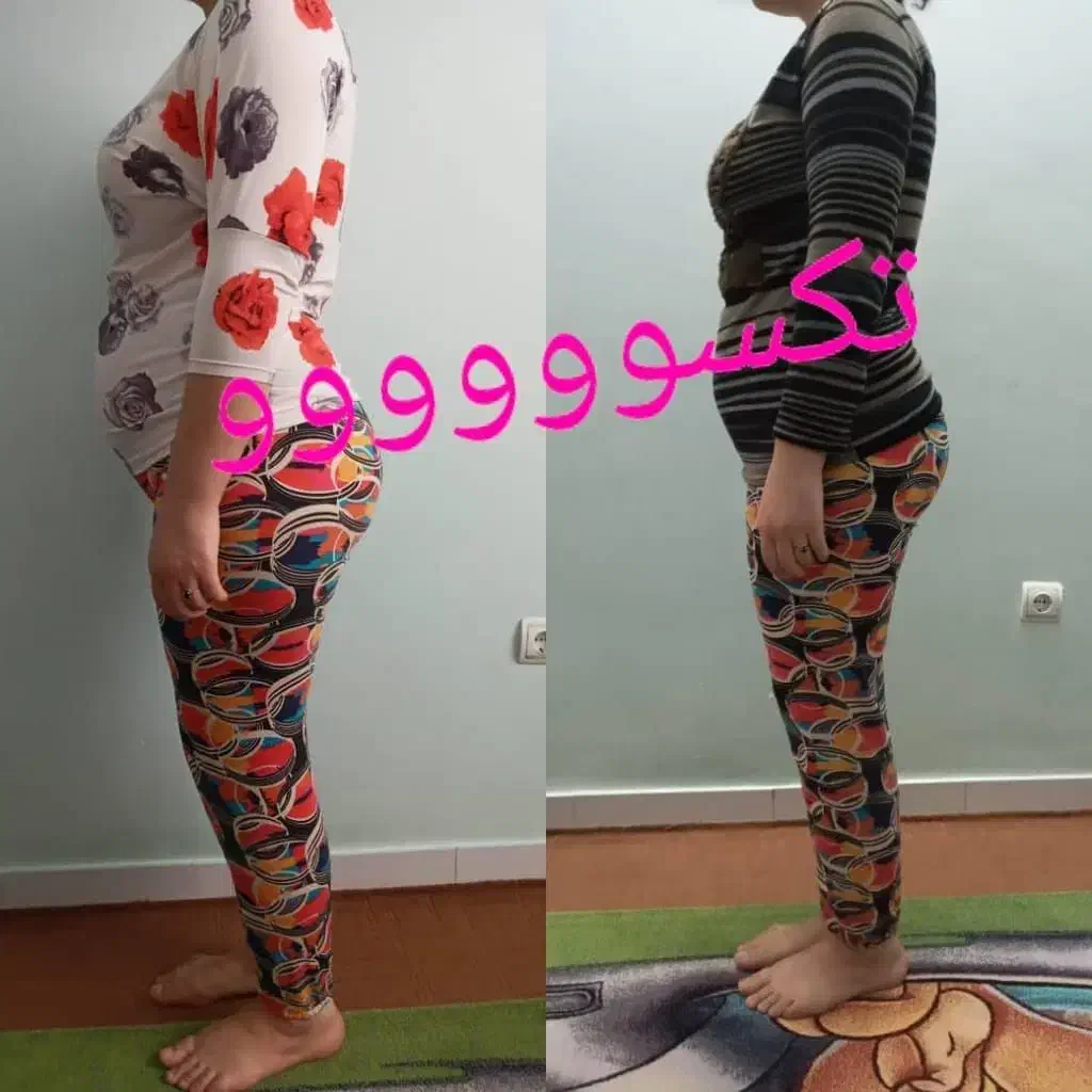 باتکسو زیبا شو اونم بدون عوارض وتضمینی|آرایشی، بهداشتی، درمانی|مشهد, شهرک ابوذر|دیوار