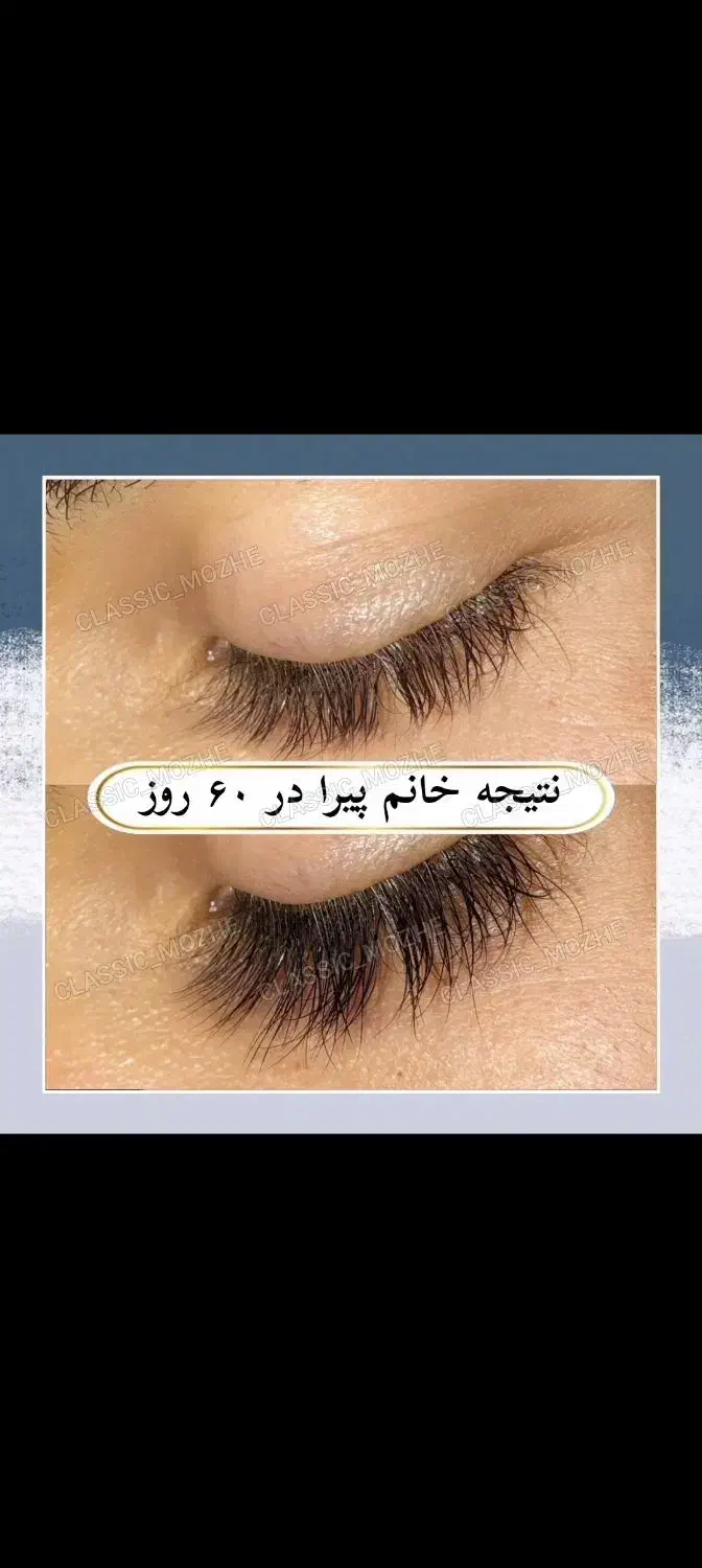 مژه ها و ابروهات رو تقویت و زیبا کن|خدمات آرایشگری و زیبایی|اهواز, گلستان|دیوار
