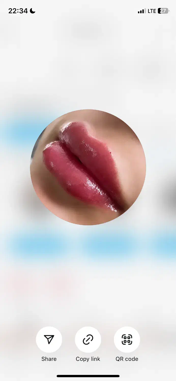 ژل و بوتاکس|خدمات آرایشگری و زیبایی|شیروان (خراسان), |دیوار