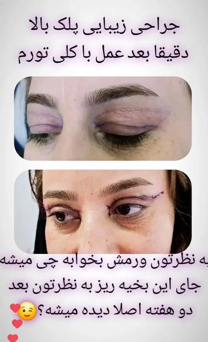 جشنواره جراحی بینی|خدمات آرایشگری و زیبایی|سقز, |دیوار