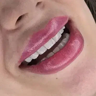 کامپوزیت دندان دندانپزشکی|خدمات آرایشگری و زیبایی|تهران, ستارخان|دیوار