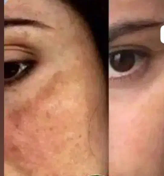 جذب نیروی خانم آنلاین باگوشی|استخدام بازاریابی و فروش|کازرون, |دیوار